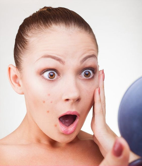Your Acne Solution
