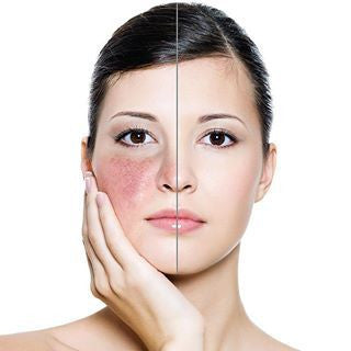 How To: Camouflage Your Skin